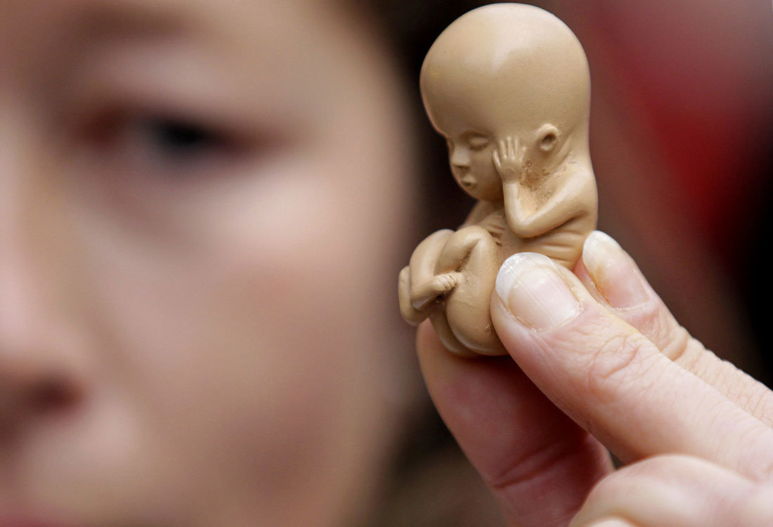 В РПЦ рассказали, какой аборт не является грехом