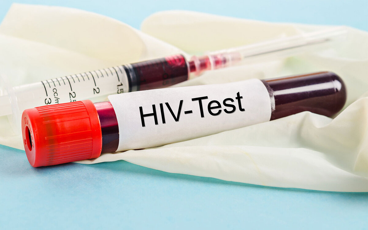 новые случаи заболевания ВИЧ
