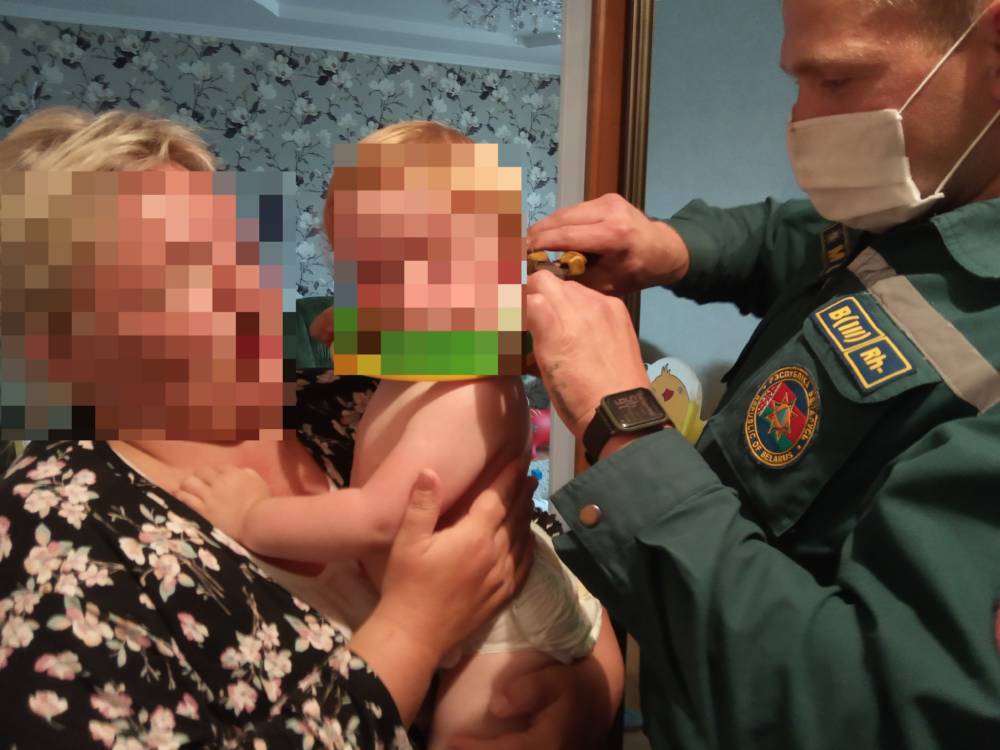 Двухлетней девочке в Ветке спасатели снимали бубен с головы