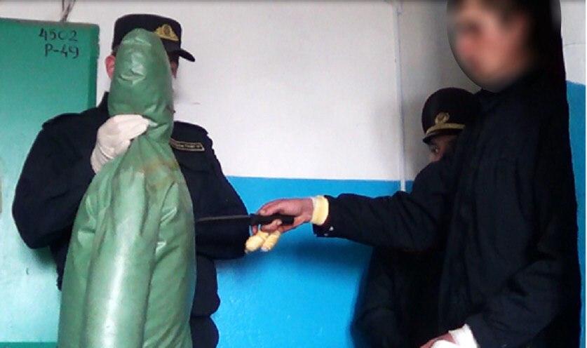 В Калинковичах 25-летний сожитель нанес своей подруге 50 ударов кухонным ножом